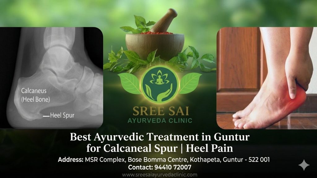 calcaneal spur treatment in guntur